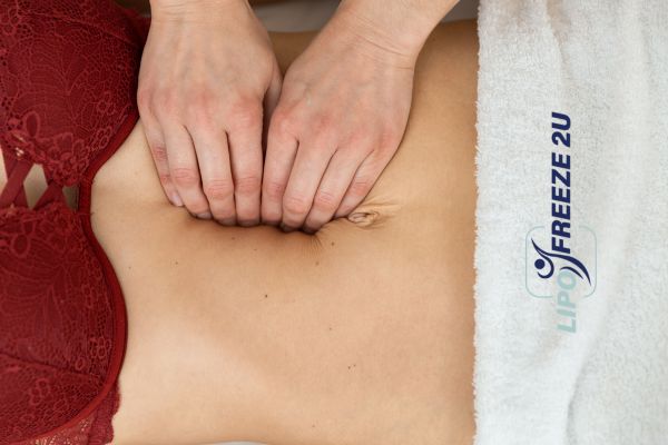 diastasis recti treatment Salford