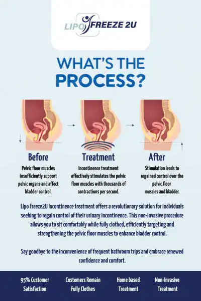 Diagram of how incontinence treatment Salford works.