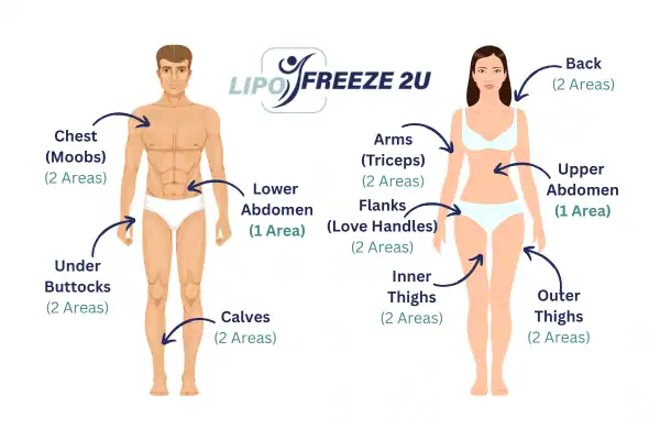 Areas you can have fat freezing treatment Salford