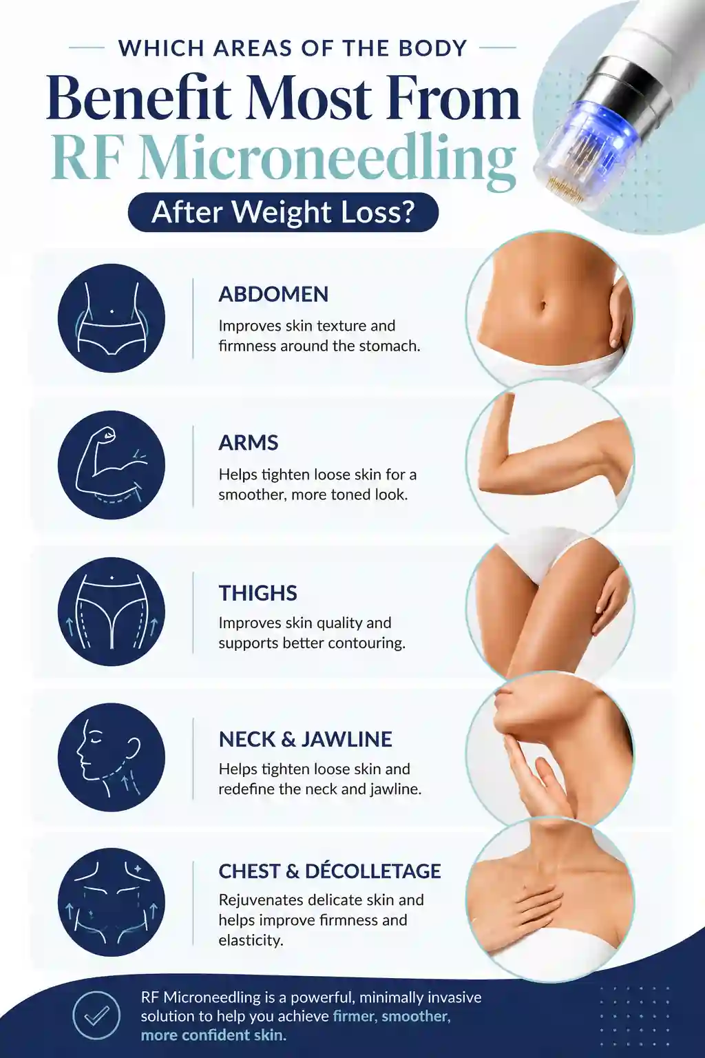 Which Areas of the Body Benefit Most From RF Microneedling After Weight Loss Salford